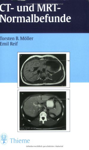 CT und MRT Normalbefunde