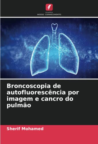 Broncoscopia de autofluorescência por imagem e cancro do pulmão von Edições Nosso Conhecimento