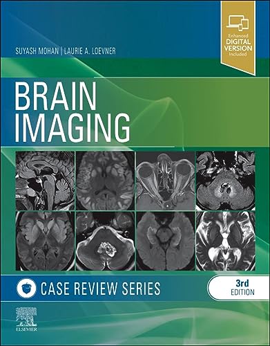 Brain Imaging: Case Review Series von Elsevier