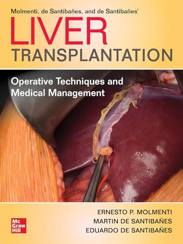 Liver Transplantation