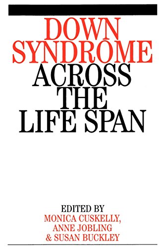 Down Syndrome Across the Life Span von John Wiley & Sons