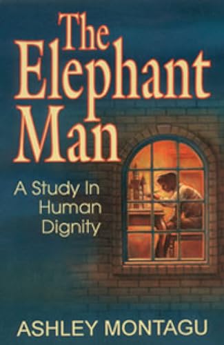 The Elephant Man: A Study in Human Dignity The Elephant Man: A Study in Human Dignity