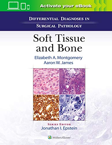 Soft Tissue and Bone (Differential Diagnoses in Surgical Pathology) von Lippincott Williams & Wilkins