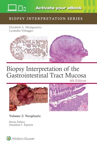 Biopsy Interpretation of the Gastrointestinal Tract Mucosa Volume 2: Neoplastic: Print + eBook with Multimedia (Biopsy Interpretation Series, 2, Band 2)