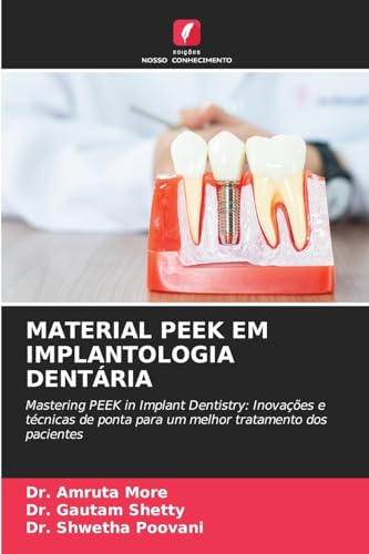 MATERIAL PEEK EM IMPLANTOLOGIA DENTÁRIA: Mastering PEEK in Implant Dentistry: Inovações e técnicas de ponta para um melhor tratamento dos pacientes von Edições Nosso Conhecimento