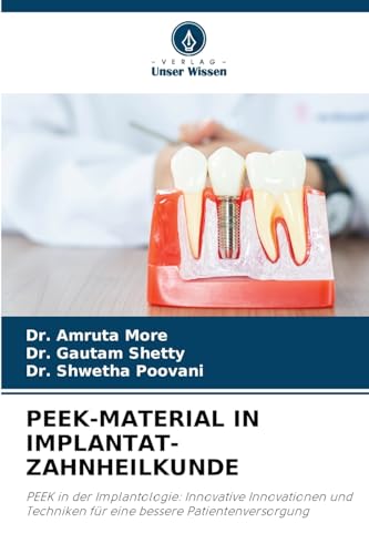 PEEK-MATERIAL IN IMPLANTAT-ZAHNHEILKUNDE: PEEK in der Implantologie: Innovative Innovationen und Techniken für eine bessere Patientenversorgung von Verlag Unser Wissen