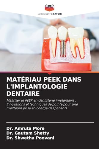 MATÉRIAU PEEK DANS L'IMPLANTOLOGIE DENTAIRE: Maîtriser le PEEK en dentisterie implantaire : Innovations et techniques de pointe pour une meilleure prise en charge des patients.DE von Editions Notre Savoir
