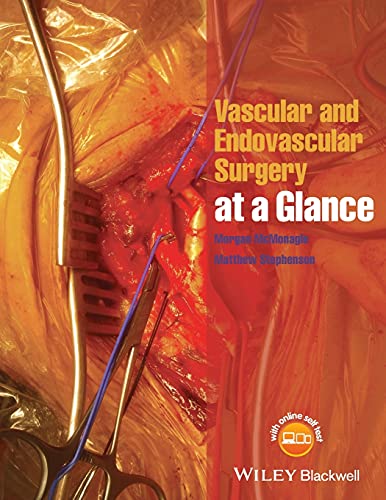 Vascular and Endovascular Surgery at a Glance von Wiley-Blackwell