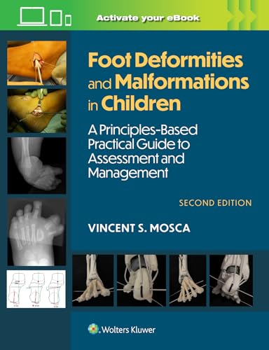 Foot Deformities and Malformations in Children: A Principles-Based, Practical Guide to Assessment and Management: Print + eBook with Multimedia von Lippincott Williams&Wilki