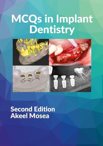 MCQs in Implant Dentistry von Lulu
