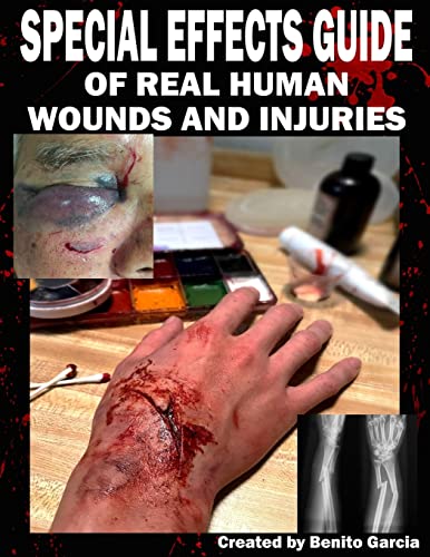 Special Effects Guide Of Real Human Wounds and Injuries: Special Effects Guide Of Real Human Wounds and Injuries von CREATESPACE