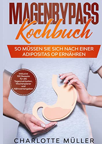 Magenbypass Kochbuch: So müssen Sie sich nach einer Adipositas OP ernähren - Inklusive 100 Rezepte für alle Tagesmahlzeiten, Wochenplaner und Nährwertangaben von Books on Demand GmbH