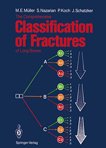 The Comprehensive Classification of Fractures of Long Bones von Springer