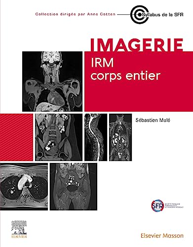 IRM corps entier von Elsevier Masson