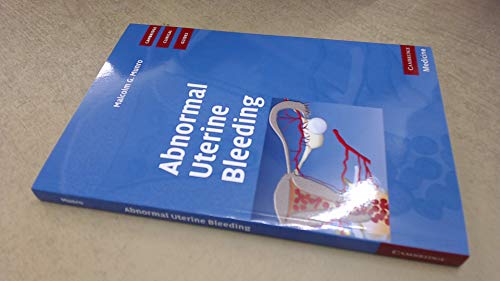 Abnormal Uterine Bleeding with DVD (Cambridge Clinical Guides)