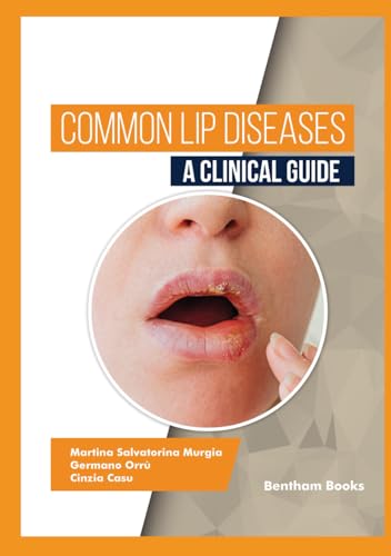 Common Lip Diseases: A Clinical Guide Common Lip Diseases: A Clinical Guide von Bentham Science Publishers