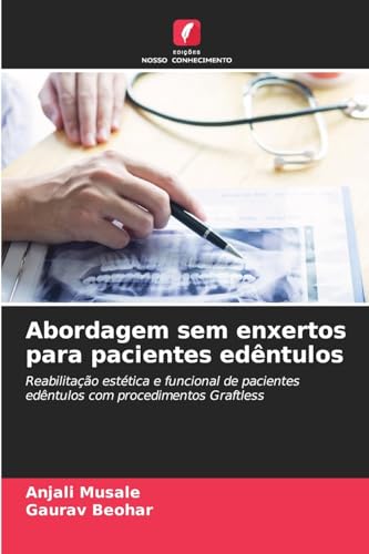 Abordagem sem enxertos para pacientes edêntulos: Reabilitação estética e funcional de pacientes edêntulos com procedimentos Graftless von Edições Nosso Conhecimento