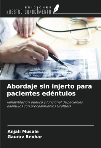 Abordaje sin injerto para pacientes edéntulos: Rehabilitación estética y funcional de pacientes edéntulos con procedimientos Graftless von Ediciones Nuestro Conocimiento