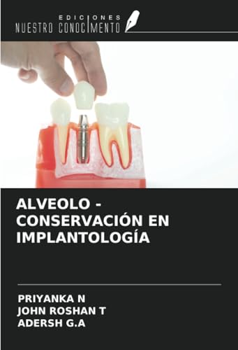 ALVEOLO - CONSERVACIÓN EN IMPLANTOLOGÍA von Ediciones Nuestro Conocimiento