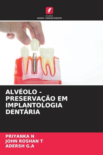 ALVÉOLO - PRESERVAÇÃO EM IMPLANTOLOGIA DENTÁRIA von Edições Nosso Conhecimento