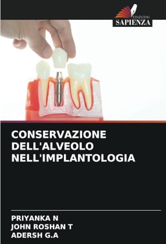 CONSERVAZIONE DELL'ALVEOLO NELL'IMPLANTOLOGIA von Edizioni Sapienza