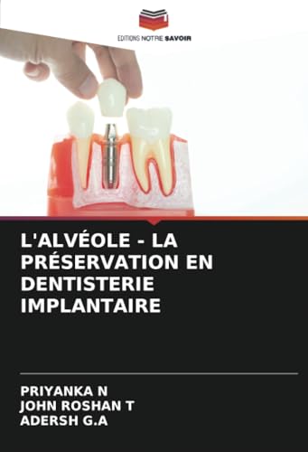 L'ALVÉOLE - LA PRÉSERVATION EN DENTISTERIE IMPLANTAIRE von Editions Notre Savoir