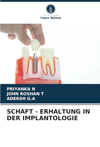 SCHAFT - ERHALTUNG IN DER IMPLANTOLOGIE von Verlag Unser Wissen