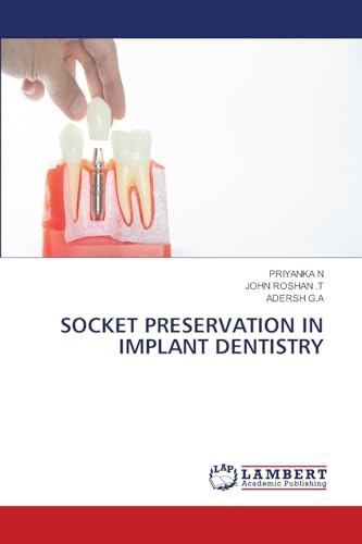 SOCKET PRESERVATION IN IMPLANT DENTISTRY von LAP LAMBERT Academic Publishing
