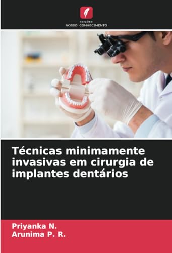 Técnicas minimamente invasivas em cirurgia de implantes dentários von Edições Nosso Conhecimento