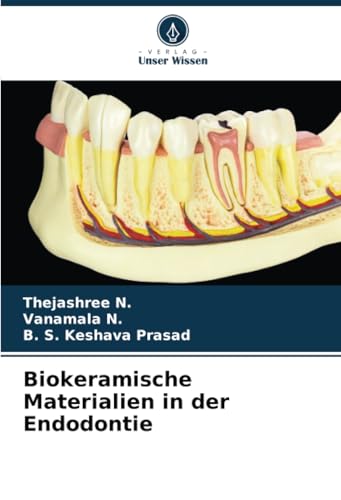 Biokeramische Materialien in der Endodontie von Verlag Unser Wissen