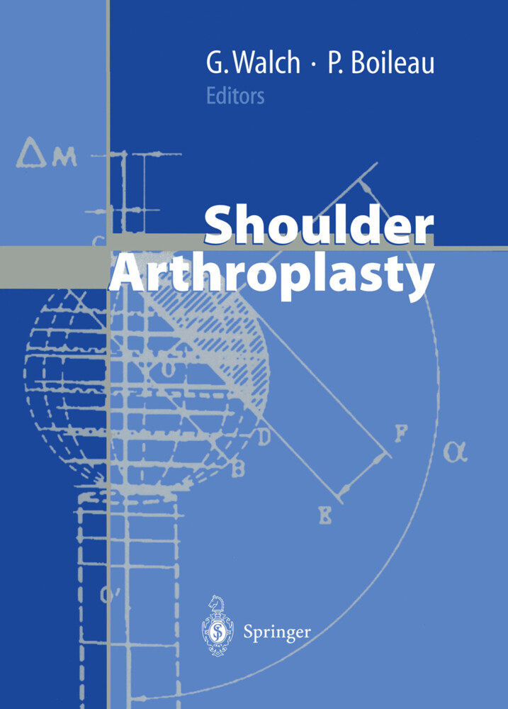 Shoulder Arthroplasty von Springer Berlin Heidelberg