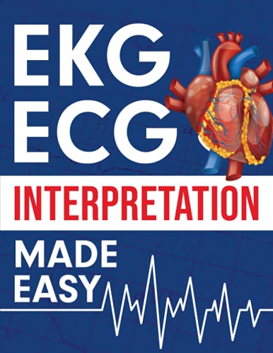 EKG | ECG Interpretation Made Easy: An Illustrated Study Guide For Students To Easily Learn How To Read & Interpret ECG Strips von NEDU LLC