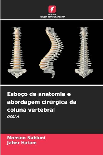 Esboço da anatomia e abordagem cirúrgica da coluna vertebral: OSSAA von Edições Nosso Conhecimento