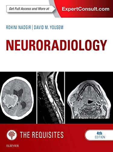 Neuroradiology: The Requisites (The Core Requisites) von Elsevier