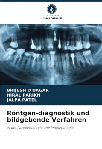 Röntgen-diagnostik und bildgebende Verfahren: In der Parodontologie und Implantologie von Verlag Unser Wissen