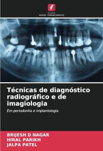 Técnicas de diagnóstico radiográfico e de imagiologia: Em periodontia e implantologia von Edições Nosso Conhecimento