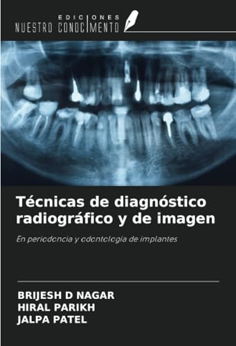 Técnicas de diagnóstico radiográfico y de imagen: En periodoncia y odontología de implantes von Ediciones Nuestro Conocimiento