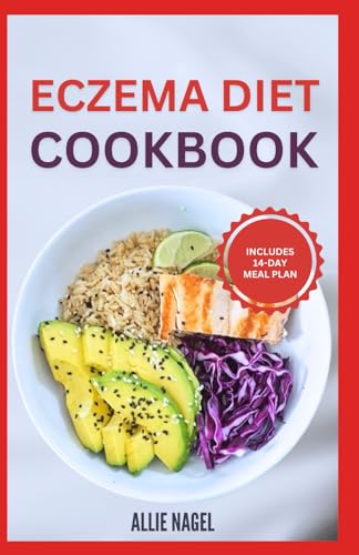 Eczema Diet Cookbook: Delicious Anti-Inflammatory Gluten-Free Recipes and Meal Plan to Detoxify, Manage Inflammation, Flare Ups & Itches von Independently published