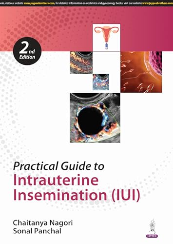 Practical Guide to Intrauterine Insemination (IUI) von Jaypee Brothers Medical Publishers