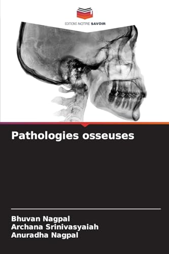 Pathologies osseuses von Editions Notre Savoir