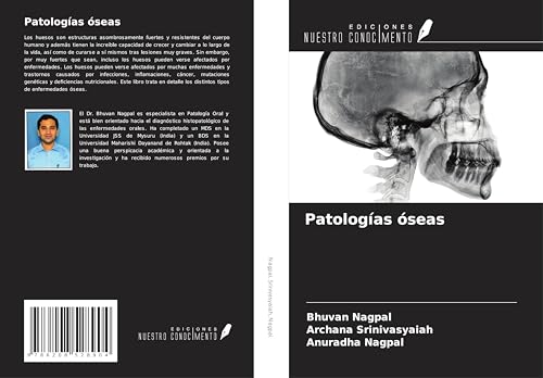 Patologías óseas von Ediciones Nuestro Conocimiento
