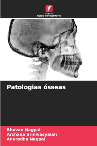Patologias ósseas von Edições Nosso Conhecimento