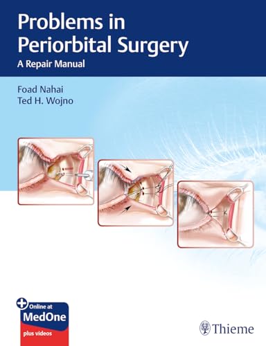Problems in Periorbital Surgery: A Repair Manual von Thieme Medical Publishers