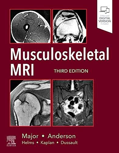 Musculoskeletal MRI von Elsevier