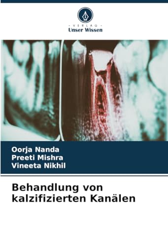 Behandlung von kalzifizierten Kanälen: DE von Verlag Unser Wissen