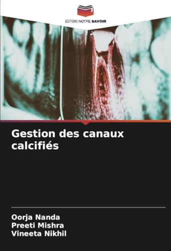 Gestion des canaux calcifiés von Editions Notre Savoir