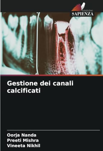 Gestione dei canali calcificati von Edizioni Sapienza