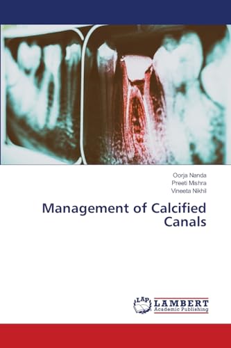 Management of Calcified Canals: DE