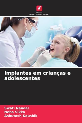 Implantes em crianças e adolescentes: DE von Edições Nosso Conhecimento