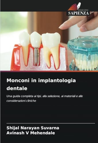 Monconi in implantologia dentale: Una guida completa ai tipi, alla selezione, ai materiali e alle considerazioni cliniche von Edizioni Sapienza